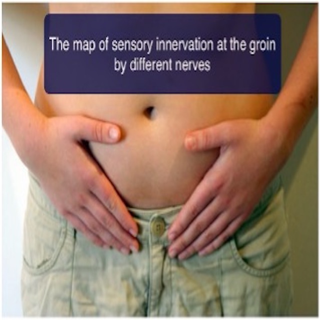 A Case Study of a Deep Groin Pain
