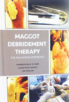 Maggot Debridement Therapy